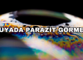 Rüyada Parazit Görmek